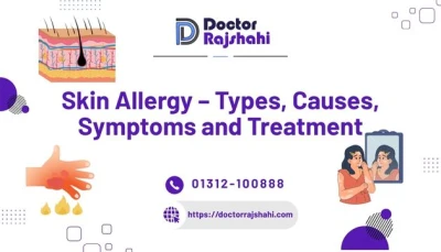 Skin Sexual Allergy Disease Specialist